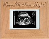 3.5 x 5 Ultrasound Frame